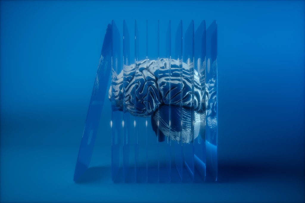 Your Business Already Has the Most Valuable AI Asset. You Just Haven't Extracted It Yet.